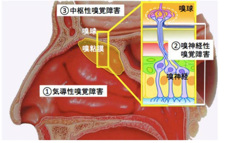 嗅覚障害診療ガイドラインより引用