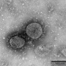 新型コロナウイルス感染症（COVID-19)による嗅覚障害